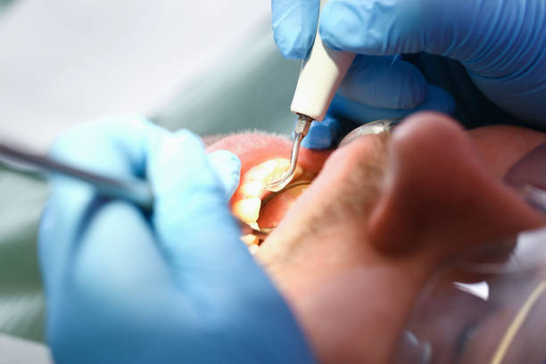 Best Emergency Cosmetic Dentistry in Thorntown, IN