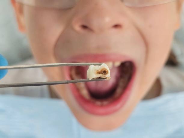 Best Weekend Emergency Dentist in Thorntown, IN