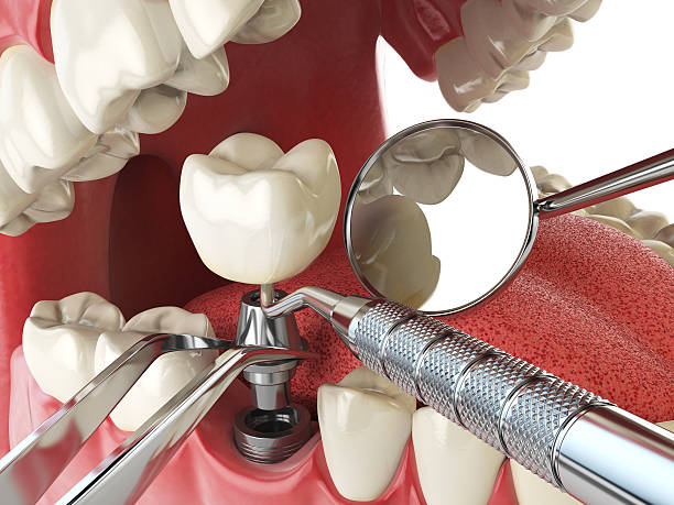 Best Orthodontic Emergency Dentist in Thorntown, IN